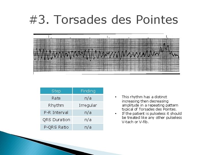 #3. Torsades Pointes Step Finding Rate n/a Rhythm Irregular P-R Interval n/a QRS Duration #3. Torsades Pointes Step Finding Rate n/a Rhythm Irregular P-R Interval n/a QRS Duration