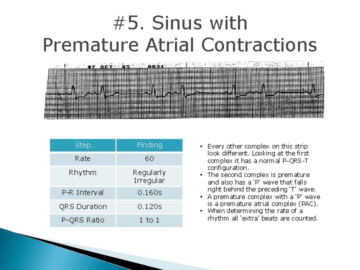 #5. Sinus with Premature Atrial Contractions Step Finding Rate 60 Rhythm Regularly Irregular P-R #5. Sinus with Premature Atrial Contractions Step Finding Rate 60 Rhythm Regularly Irregular P-R