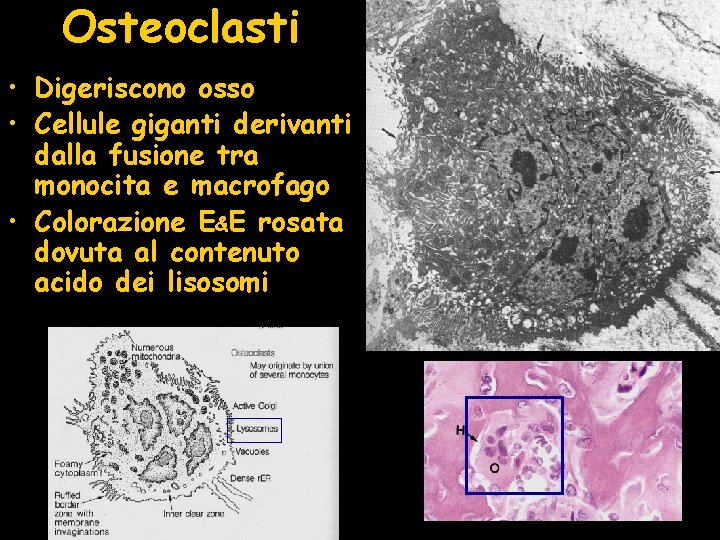 Osteoclasti • Digeriscono osso • Cellule giganti derivanti dalla fusione tra monocita e macrofago