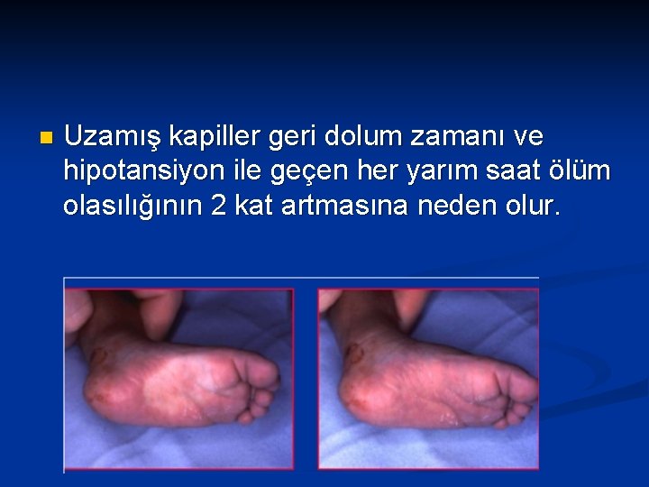 n Uzamış kapiller geri dolum zamanı ve hipotansiyon ile geçen her yarım saat ölüm