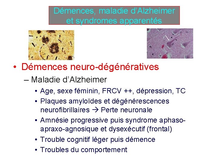 Démences, maladie d’Alzheimer et syndromes apparentés • Démences neuro-dégénératives – Maladie d’Alzheimer • Age,