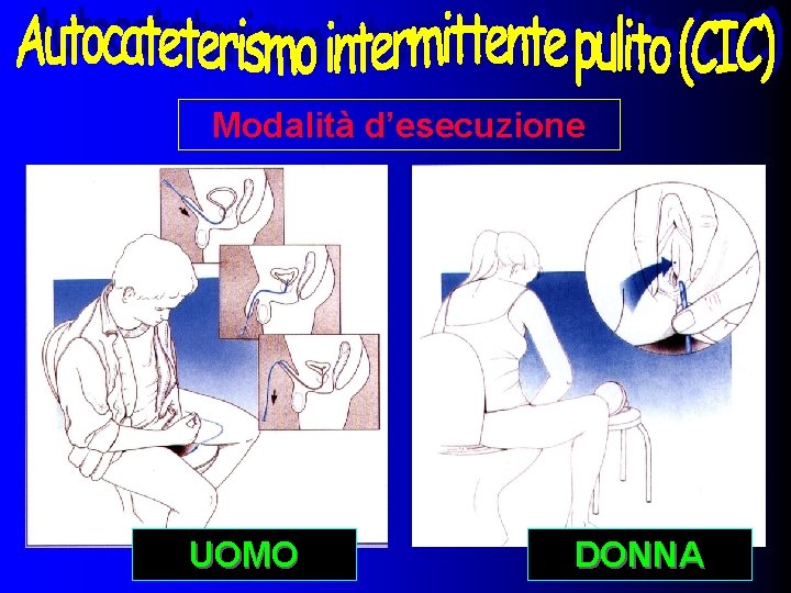 Modalità d’esecuzione UOMO DONNA 