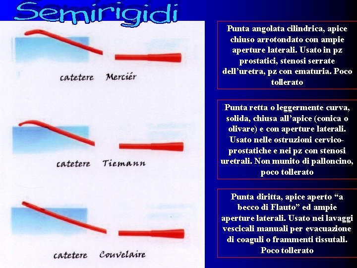 Punta angolata cilindrica, apice chiuso arrotondato con ampie aperture laterali. Usato in pz prostatici,