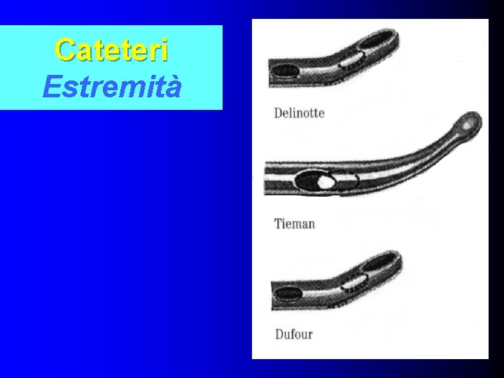 Cateteri Estremità 