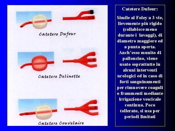 Catetere Dufour: Simile al Foley a 3 vie, lievemente più rigido (collabisce meno durante