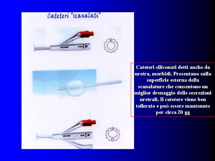 Cateteri siliconati detti anche da uretra, morbidi. Presentano sulla superficie esterna della scanalature che