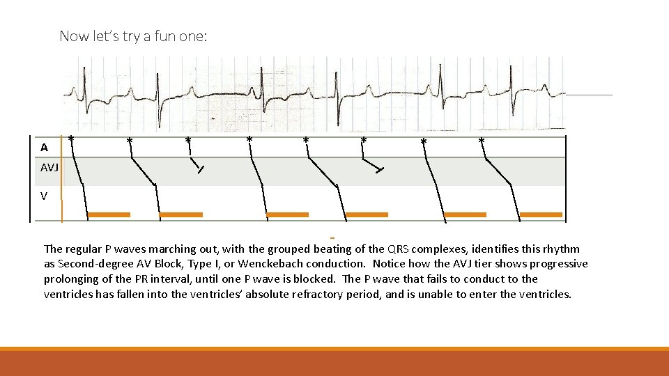 Now let’s try a fun one: A * * * * AVJ V The