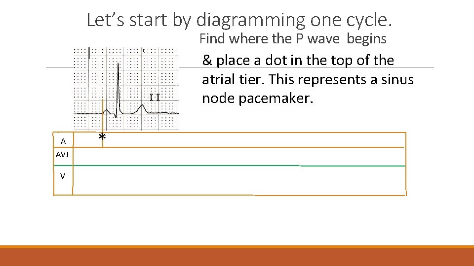 Let’s start by diagramming one cycle. Find where the P wave begins & place