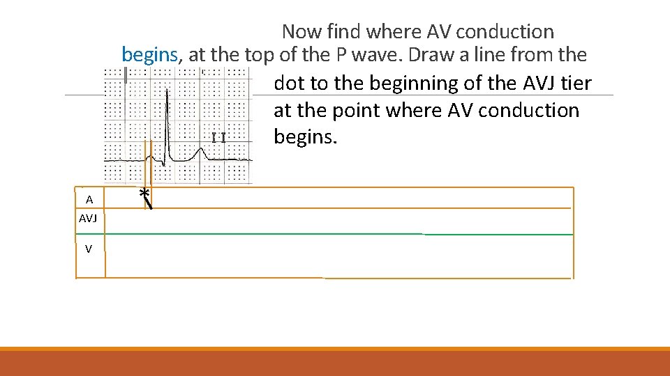Now find where AV conduction begins, at the top of the P wave. Draw