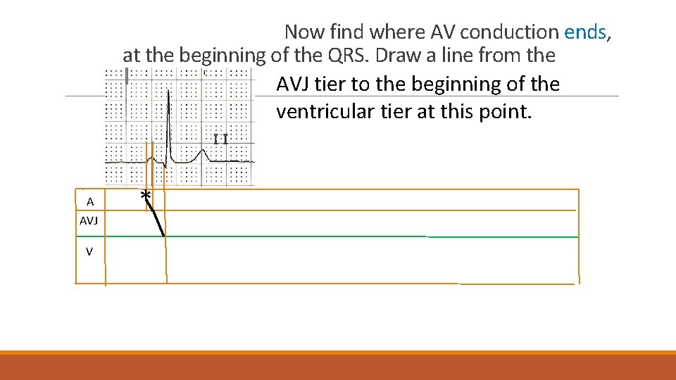 Now find where AV conduction ends, at the beginning of the QRS. Draw a
