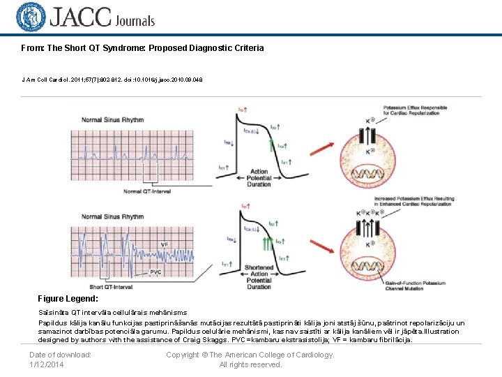 From: The Short QT Syndrome: Proposed Diagnostic Criteria J Am Coll Cardiol. 2011; 57(7):