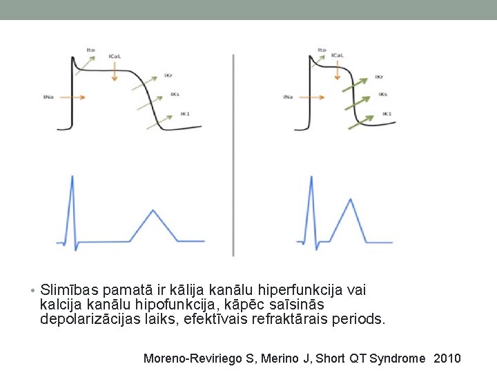  • Slimības pamatā ir kālija kanālu hiperfunkcija vai kalcija kanālu hipofunkcija, kāpēc saīsinās