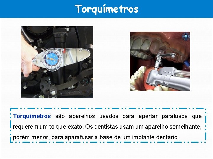 Torquímetros são aparelhos usados para apertar parafusos que requerem um torque exato. Os dentistas