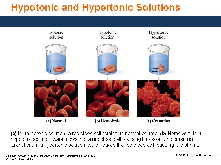 Hypotonic and Hypertonic Solutions (a) In an isotonic solution, a red blood cell retains