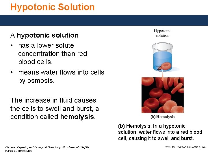Hypotonic Solution A hypotonic solution • has a lower solute concentration than red blood