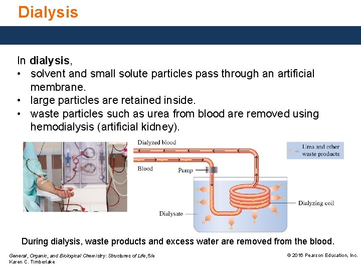 Dialysis In dialysis, • solvent and small solute particles pass through an artificial membrane.