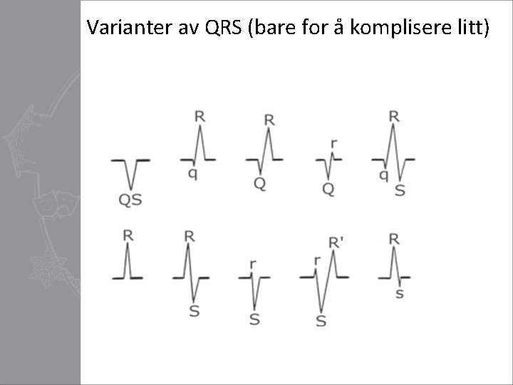 Varianter av QRS (bare for å komplisere litt) 