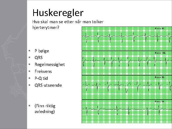 Huskeregler Hva skal man se etter når man tolker hjerterytmer? § § § P