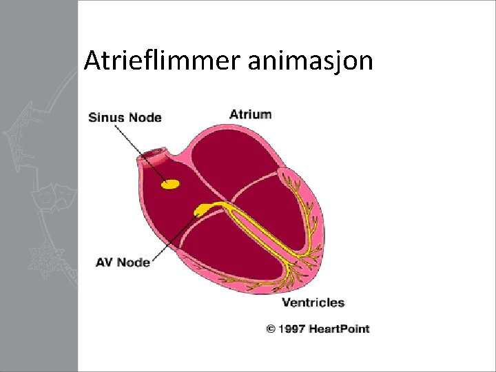 Atrieflimmer animasjon 