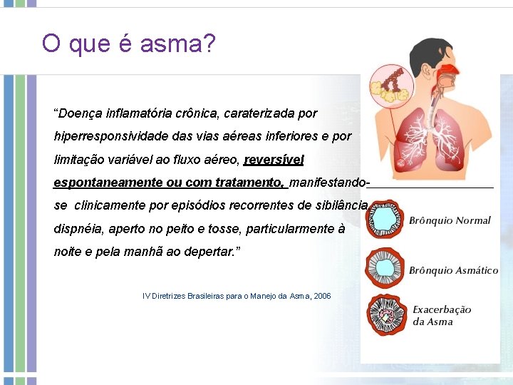 O que é asma? “Doença inflamatória crônica, caraterizada por hiperresponsividade das vias aéreas inferiores O que é asma? “Doença inflamatória crônica, caraterizada por hiperresponsividade das vias aéreas inferiores