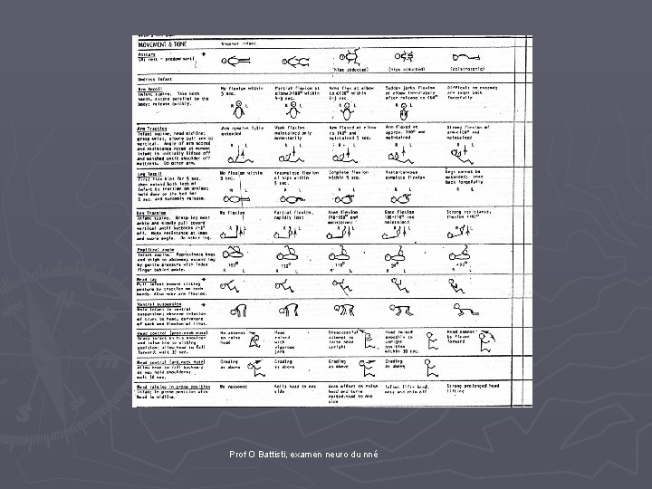 Prof O Battisti, examen neuro du nné 