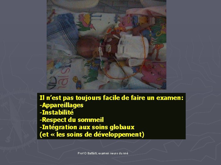 Il n’est pas toujours facile de faire un examen: -Appareillages -Instabilité -Respect du sommeil