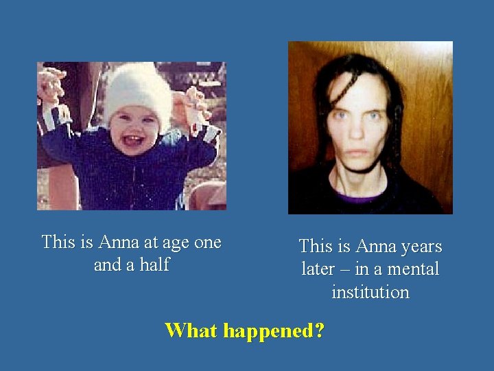 This is Anna at age one and a half This is Anna years later