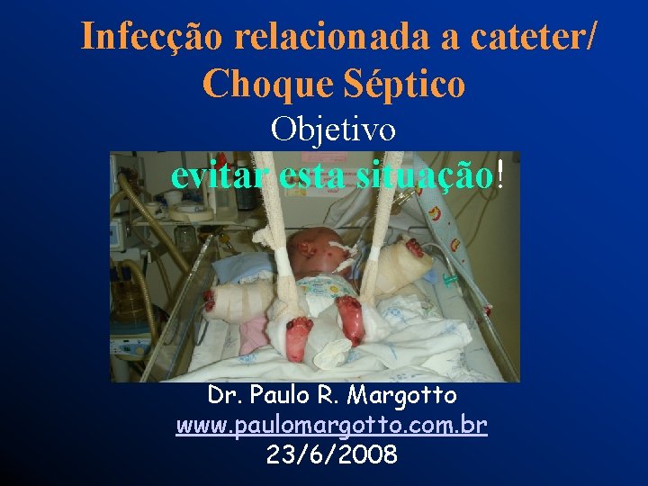 Infecção relacionada a cateter/ Choque Séptico Objetivo evitar esta situação! Dr. Paulo R. Margotto