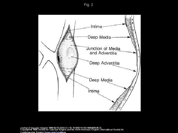 Fig. 2 Journal of Vascular Surgery 1989 9213 -223 DOI: (10. 1016/0741 -5214(89)90040 -2)