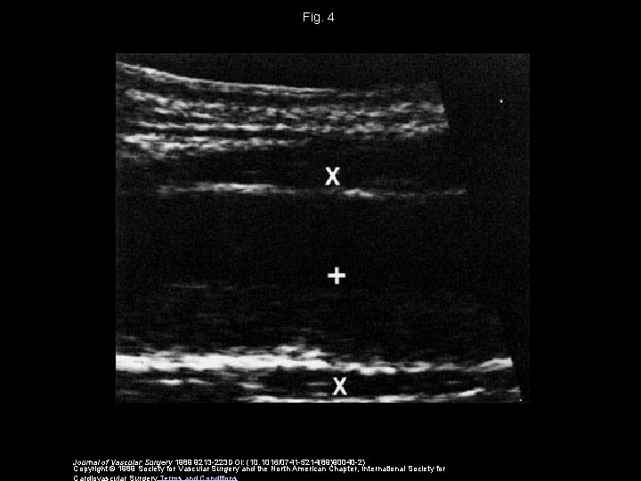 Fig. 4 Journal of Vascular Surgery 1989 9213 -223 DOI: (10. 1016/0741 -5214(89)90040 -2)