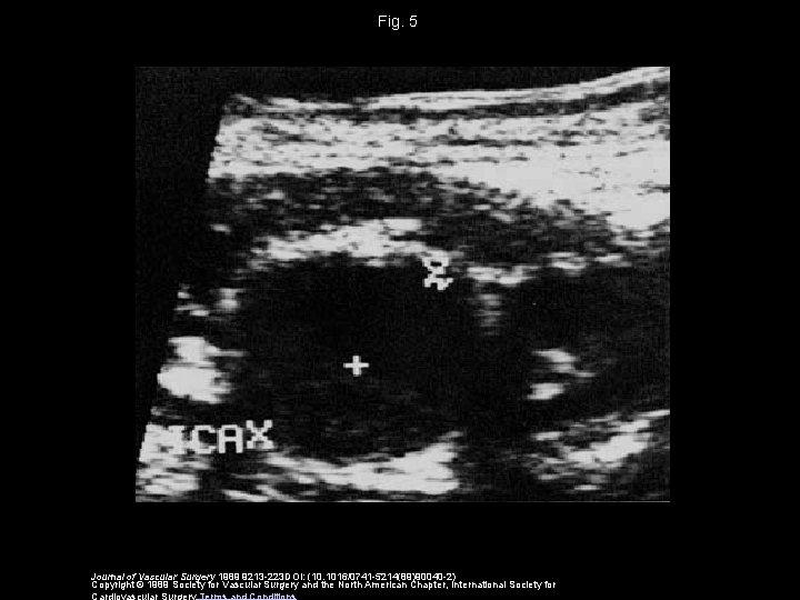 Fig. 5 Journal of Vascular Surgery 1989 9213 -223 DOI: (10. 1016/0741 -5214(89)90040 -2)