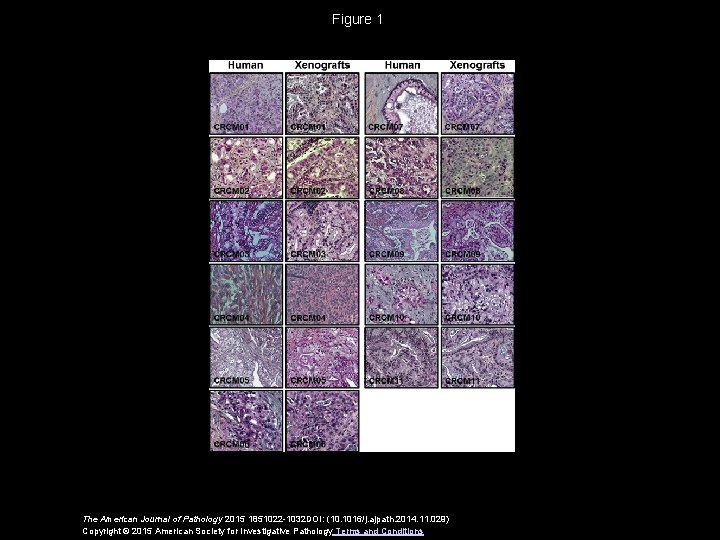 Figure 1 The American Journal of Pathology 2015 1851022 -1032 DOI: (10. 1016/j. ajpath.