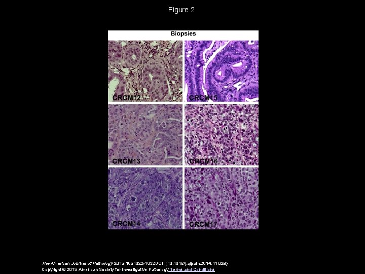 Figure 2 The American Journal of Pathology 2015 1851022 -1032 DOI: (10. 1016/j. ajpath.