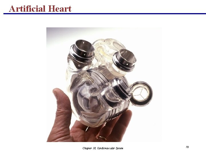 Artificial Heart Chapter 18, Cardiovascular System 76 