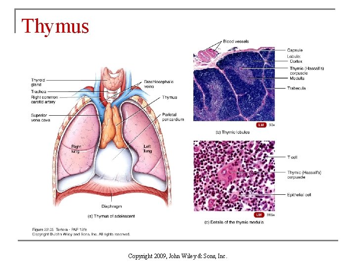 Chapter 22 The Lymphatic System and Immunity Copyright