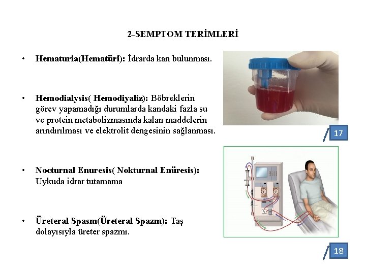 2 -SEMPTOM TERİMLERİ • Hematuria(Hematüri): İdrarda kan bulunması. • Hemodialysis( Hemodiyaliz): Böbreklerin görev yapamadığı