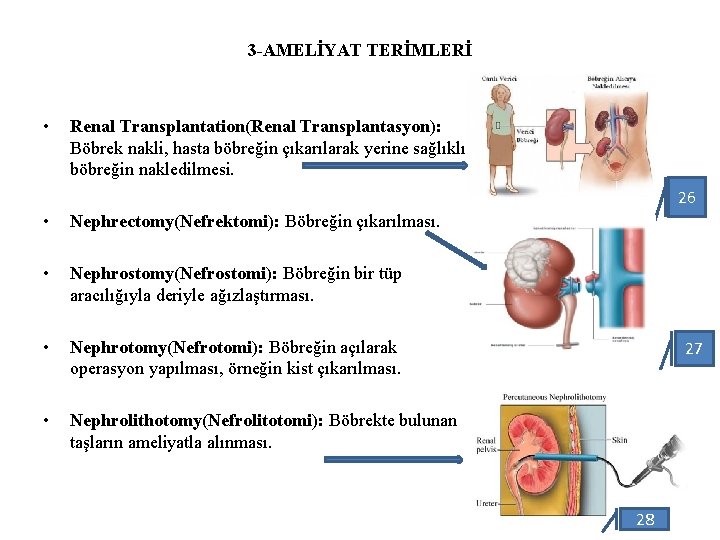 3 -AMELİYAT TERİMLERİ • Renal Transplantation(Renal Transplantasyon): Böbrek nakli, hasta böbreğin çıkarılarak yerine sağlıklı