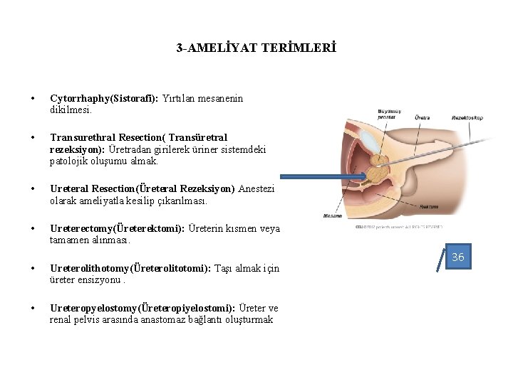 3 -AMELİYAT TERİMLERİ • Cytorrhaphy(Sistorafi): Yırtılan mesanenin dikilmesi. • Transurethral Resection( Transüretral rezeksiyon): Üretradan