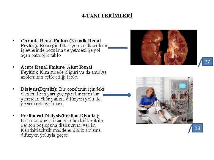 4 -TANI TERİMLERİ • Chronic Renal Failure(Kronik Renal Feylür): Böbreğin filtrasyon ve düzenleme işlevlerinde