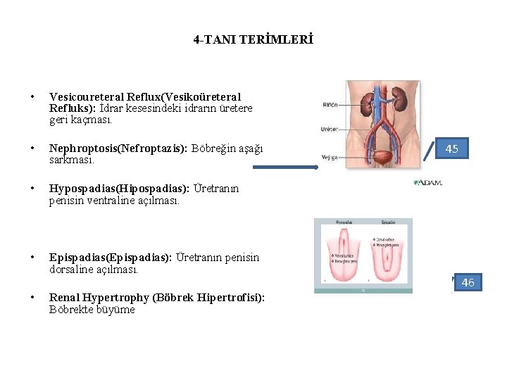 4 -TANI TERİMLERİ • Vesicoureteral Reflux(Vesikoüreteral Refluks): İdrar kesesindeki idrarın üretere geri kaçması. •