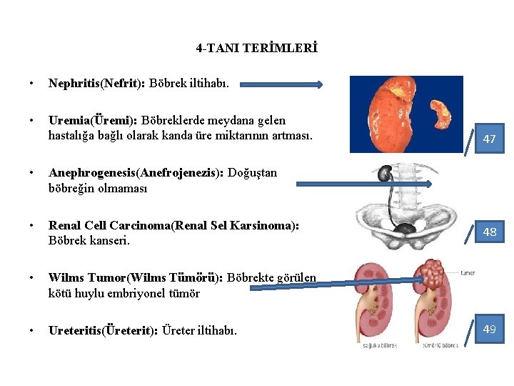 4 -TANI TERİMLERİ • Nephritis(Nefrit): Böbrek iltihabı. • Uremia(Üremi): Böbreklerde meydana gelen hastalığa bağlı