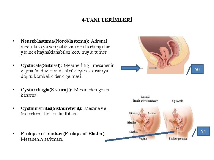 4 -TANI TERİMLERİ • Neuroblastoma(Nöroblastoma): Adrenal medulla veya sempatik zincirin herhangi bir yerinde kaynaklanabilen