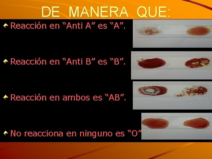 DE MANERA QUE: Reacción en “Anti A” es “A”. Reacción en “Anti B” es