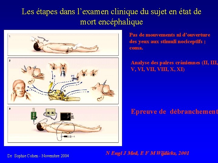 Les étapes dans l’examen clinique du sujet en état de mort encéphalique Pas de