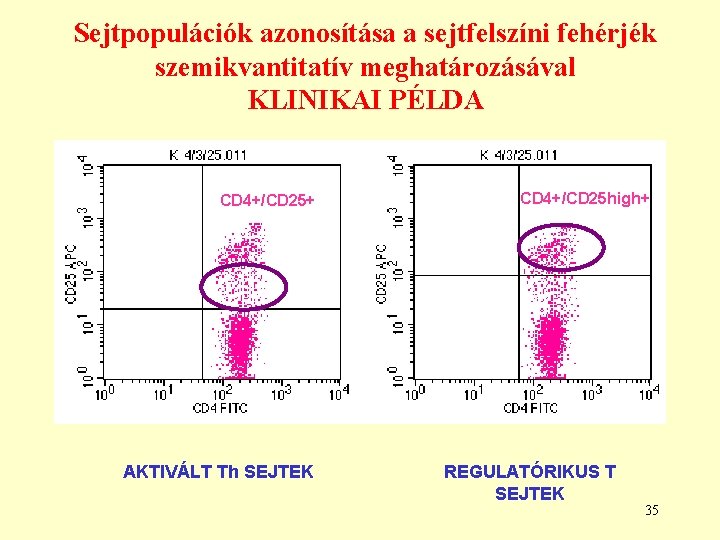 Sejtpopulációk azonosítása a sejtfelszíni fehérjék szemikvantitatív meghatározásával KLINIKAI PÉLDA CD 4+/CD 25+ AKTIVÁLT Th Sejtpopulációk azonosítása a sejtfelszíni fehérjék szemikvantitatív meghatározásával KLINIKAI PÉLDA CD 4+/CD 25+ AKTIVÁLT Th