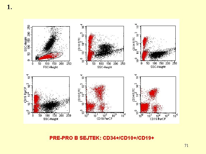 1. PRE-PRO B SEJTEK: CD 34+/CD 10+/CD 19+ 71 1. PRE-PRO B SEJTEK: CD 34+/CD 10+/CD 19+ 71