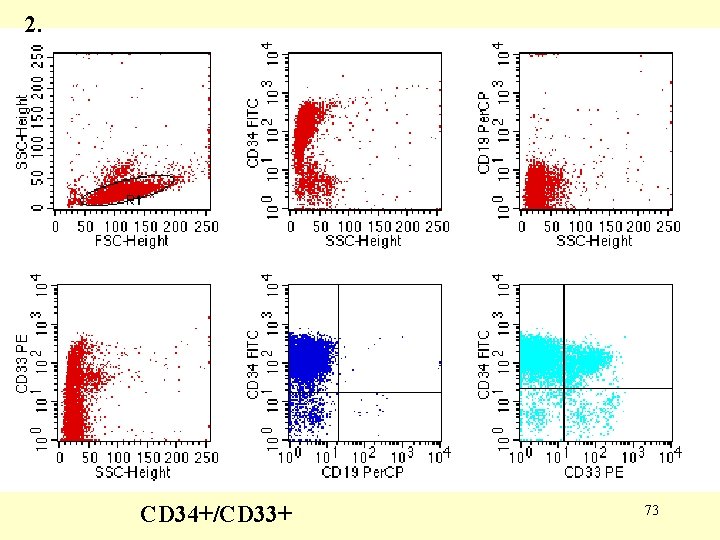2. CD 34+/CD 33+ 73 2. CD 34+/CD 33+ 73