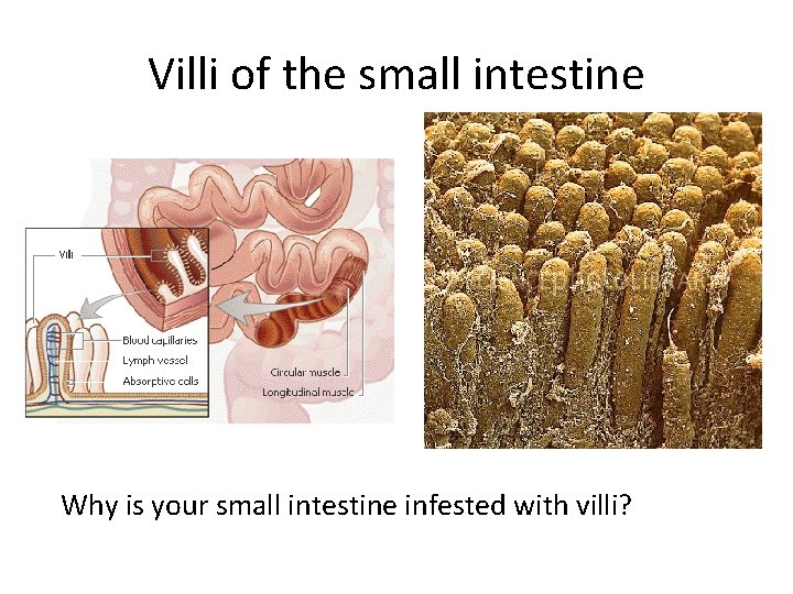 Villi of the small intestine Why is your small intestine infested with villi? 