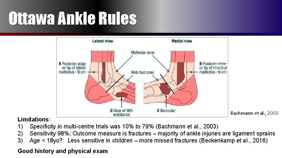 Ottawa Ankle Rules medial Bachmann et al. , 2003 Limitations: 1) Specificity in multi-centre