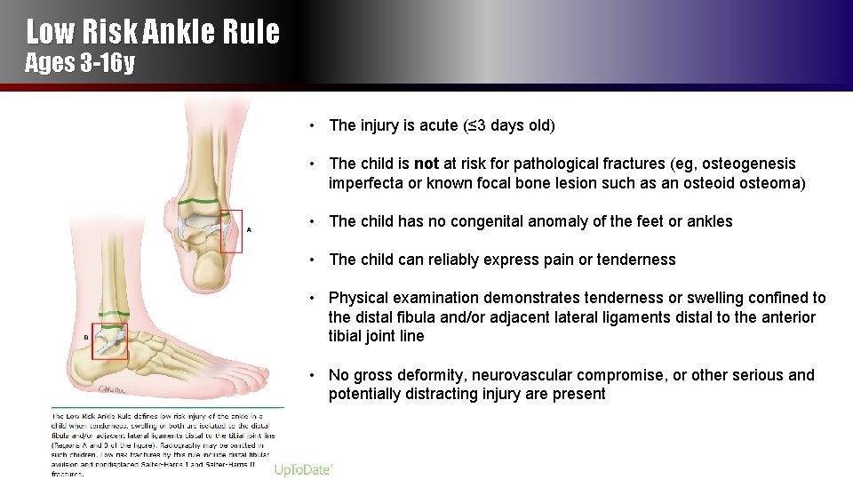 Low Risk Ankle Rule Ages 3 -16 y • The injury is acute (≤